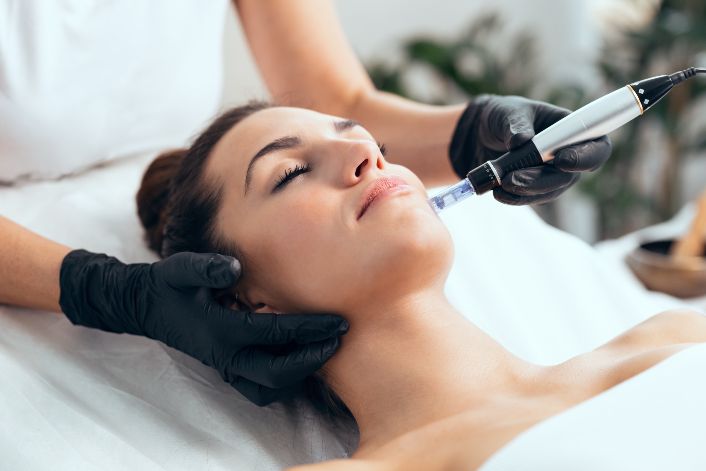 Biologic microneedling treatment